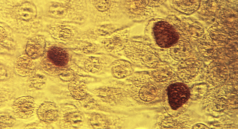Chlamydia trachomatis na podłożu MoCoya. Źródło: CDC/ Dr. E. Arum; Dr. N. Jacobs