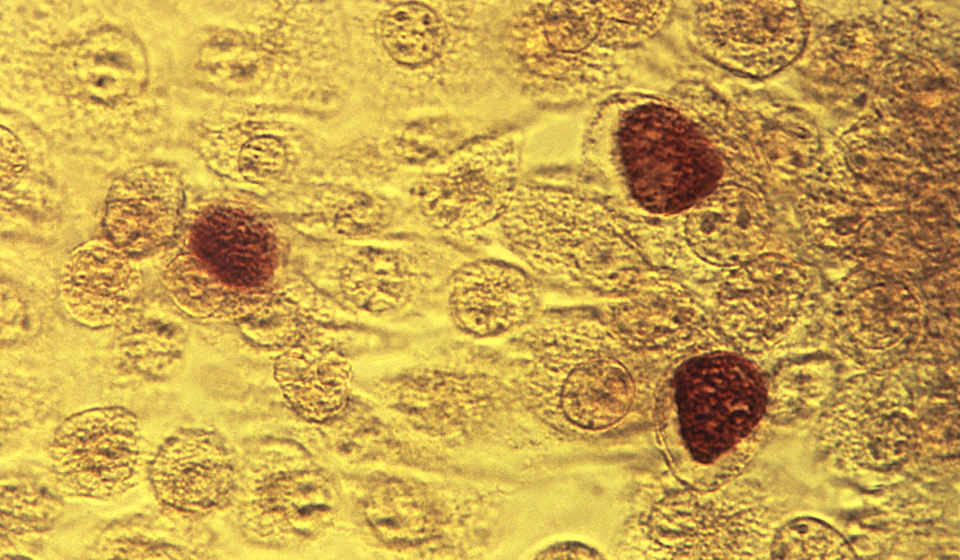 Chlamydia trachomatis na podłożu McCoya. Źródło: CDC/ Dr. E. Arum; Dr. N. Jacobs