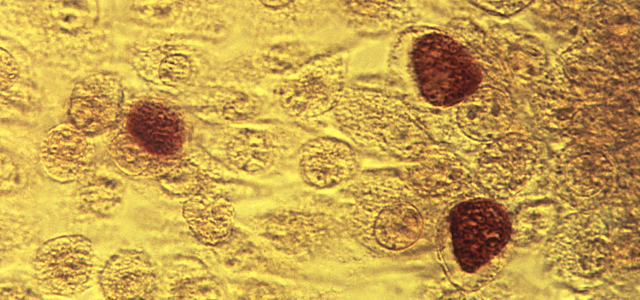Chlamydia trachomatis na podłożu MoCoya. Źródło: CDC/ Dr. E. Arum; Dr. N. Jacobs